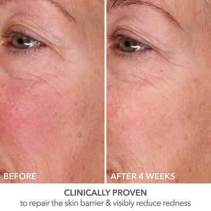 Dr Dennis Gross DermInfusions Fill + Repair Serum: Immediately Fills Lines, Plumps & Repairs, 1 oz