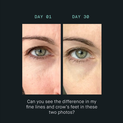 oneskin EYE OS-01 Peptide Topical Supplement | Skin Longevity Age Reversal Eye Cream | Safe for Sensitive Skin, Fragrance-Free, 20 mL / 0.67 oz