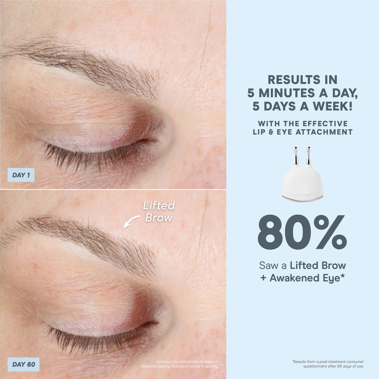 NuFACE Trinity+ Microcurrent Facial Device + Effective Lip & Eye Attachment - FDA Cleared Skin Tightening & Face Toning Device for Targeted Treatment + Microcurrent Gel Activator, Silk Crème & Brush