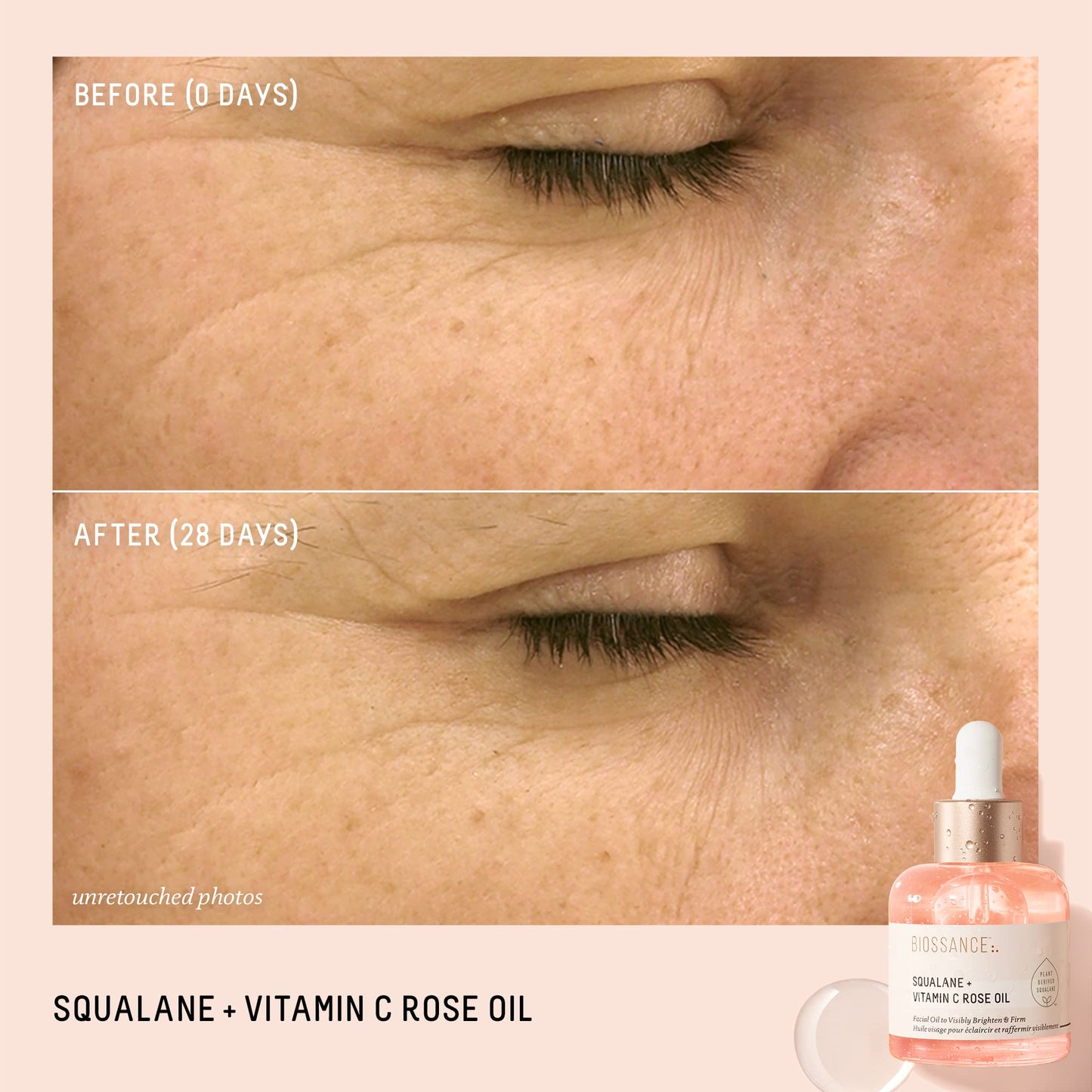 BIOSSANCE Squalane + Vitamin C Rose Advanced Facial Oil - Brightening, Firming, and Hydrating Serum for All Skin Types - Chios Crystal Oil, Damascus Rose Extract & Squalane for Radiance - 1oz