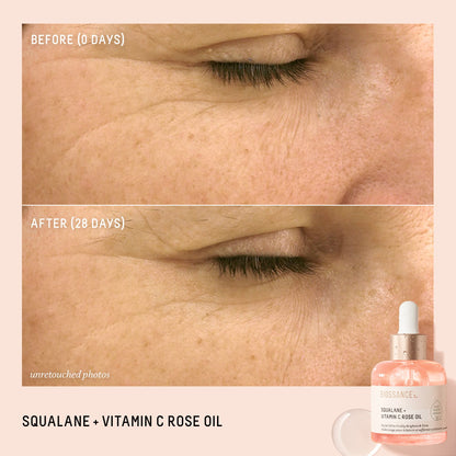 BIOSSANCE Squalane + Vitamin C Rose Advanced Facial Oil - Brightening, Firming, and Hydrating Serum for All Skin Types - Chios Crystal Oil, Damascus Rose Extract & Squalane for Radiance - 1oz