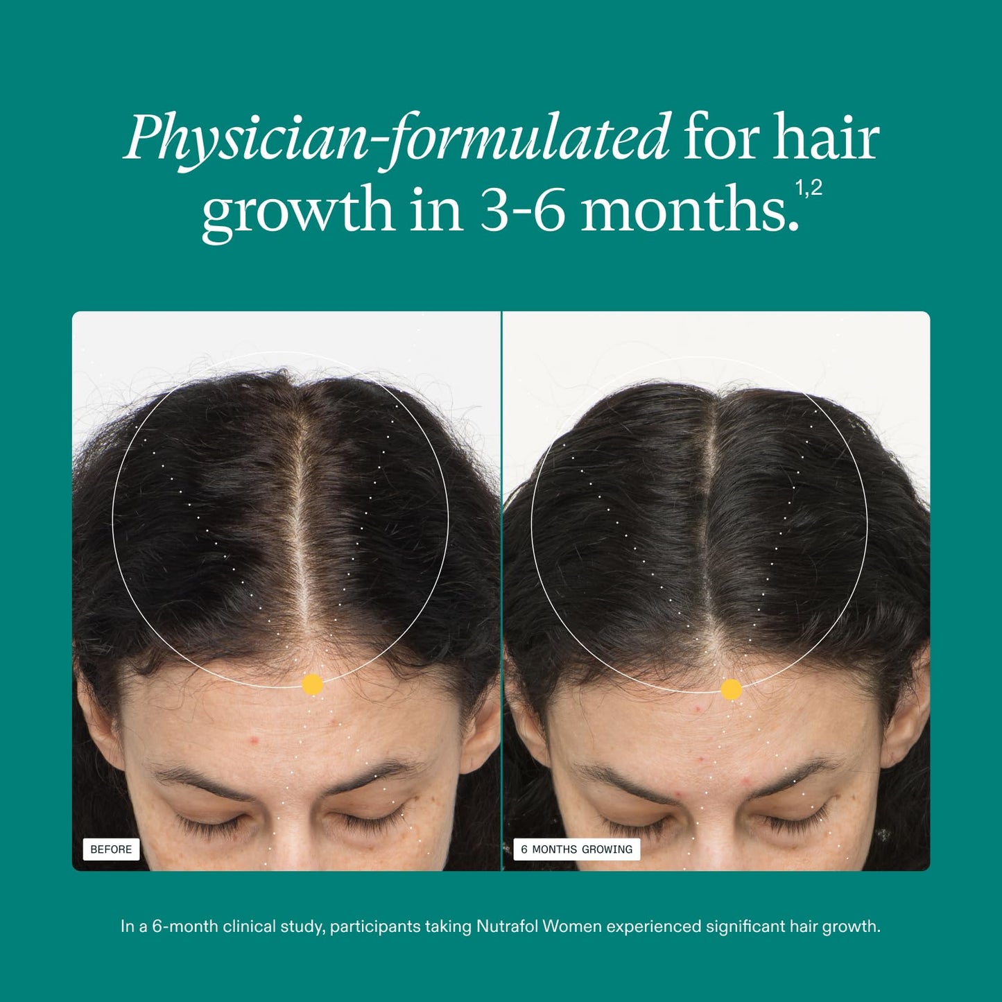 Nutrafol Women's Hair Growth Supplements, Ages 18-44, Clinically Proven for Visibly Thicker and Stronger Hair in 3-6 Months, Dermatologist Recommended - 2 Month Supply, 2 Refill Pouches