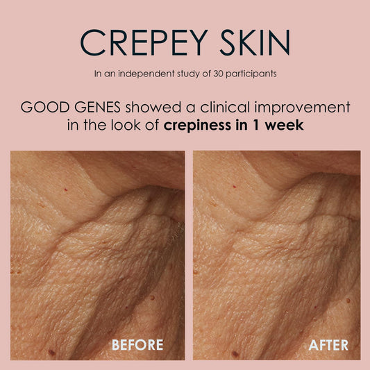 Sunday Riley Good Genes All-in-One Lactic Acid Treatment Face Serum