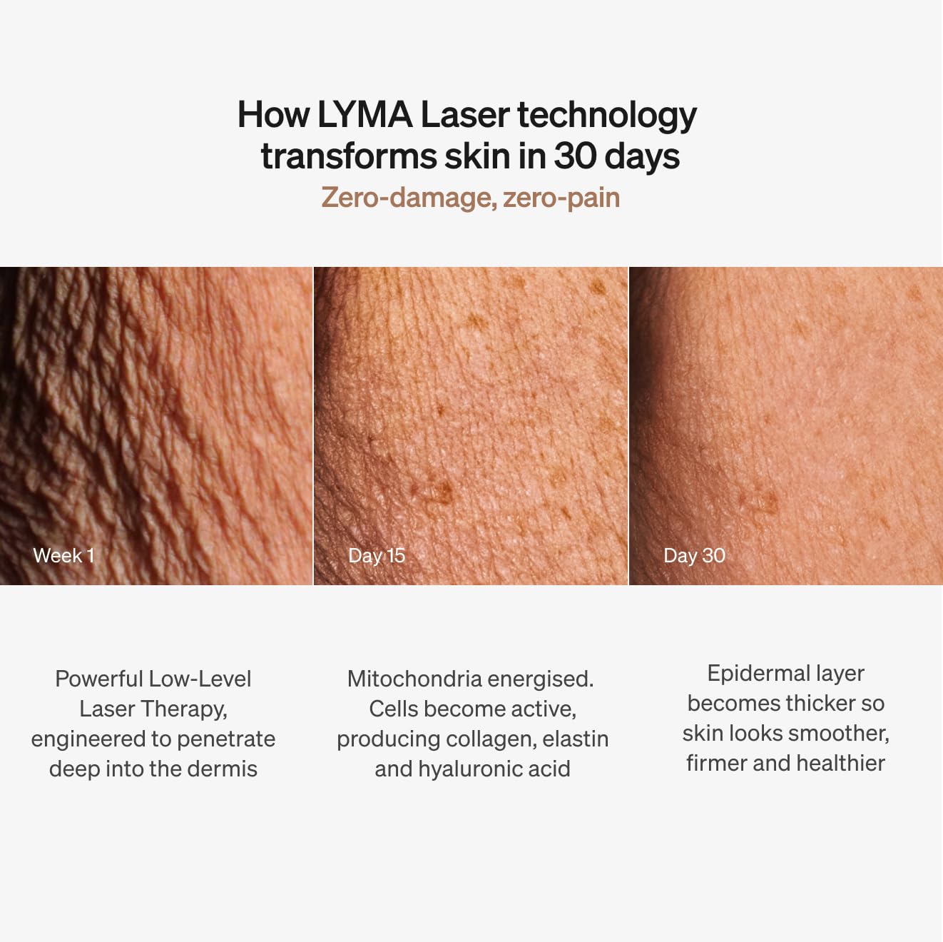 Laser Device