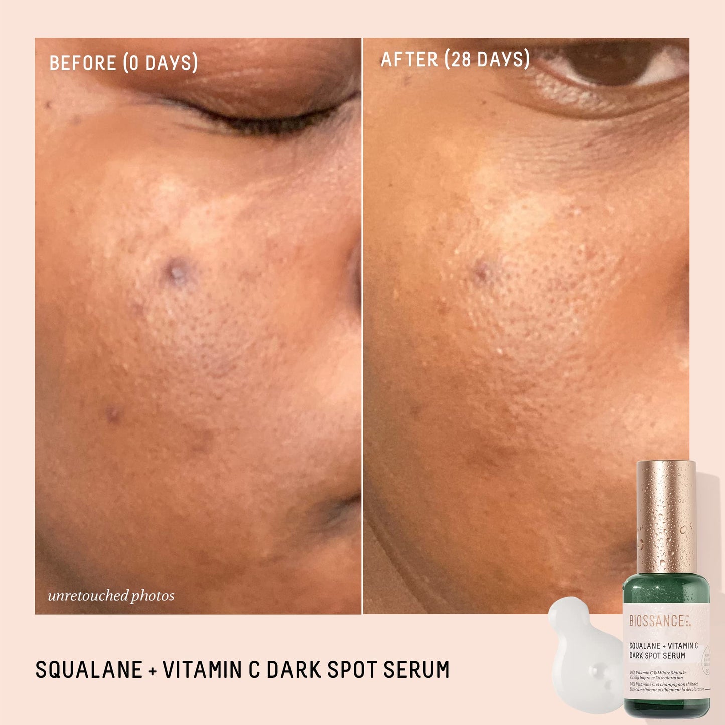 Biossance Squalane + Vitamin C Dark Spot Face Serum – 10% Vitamin C Serum & White Shiitake – Hydrating, Fragrance-Free, Non-Irritating, for Daily Use for All Skin Types, 1.01 Fl Oz