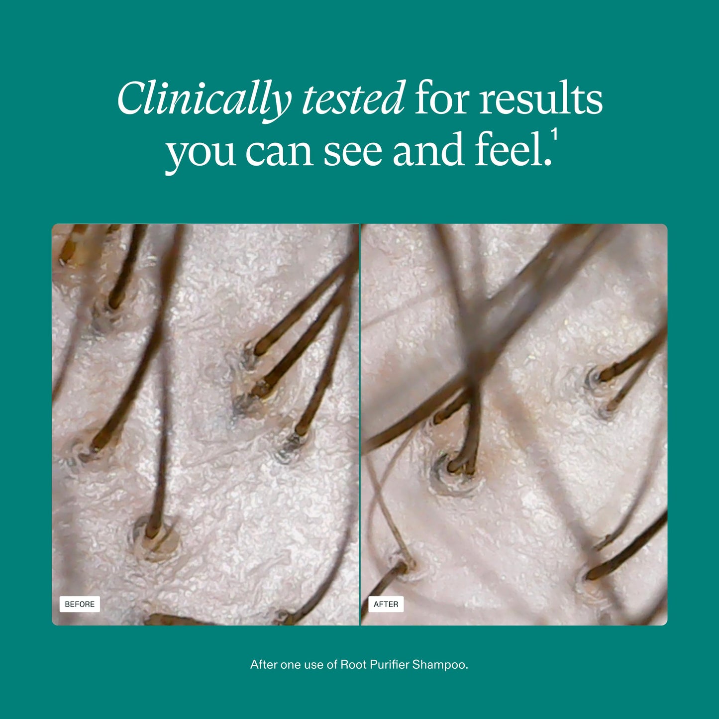 Nutrafol Shampoo, Cleanse and Hydrate Hair and Scalp, Improves Hair Volume, Strength and Texture, Physician-formulated for Thinning Hair, Color Safe, Sulfate Free - 8.1 Fl Oz Bottle