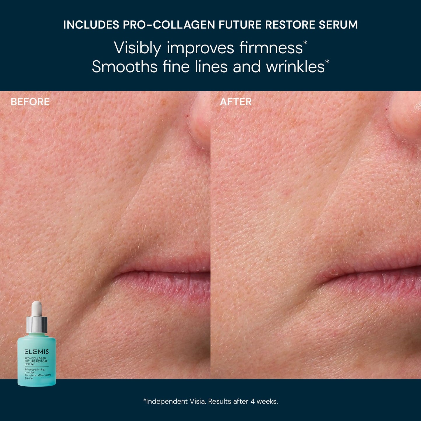 ELEMIS x Aston Martin Formula One™ Team Iconic Skincare Collection ($350 Value)