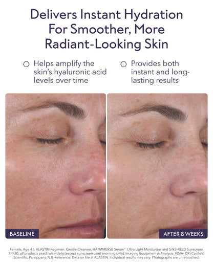 ALASTIN Skincare Hyaluronic Acid HA IMMERSE Moisturizing Face Serum (1 oz) | Restorative Serum Combats Dry, Dehydrated Skin | For Radiant, Glowing Skin