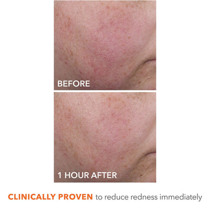 Dr Dennis Gross DermInfusions Blur + Repair Cream, Instantly Blurs Fine Lines, Smooths Skin with Satin-Matte Finish, Visibly Plumps & Firms, Reduces Redness, and Improves Skin Elasticity, 1.7 Fl Oz