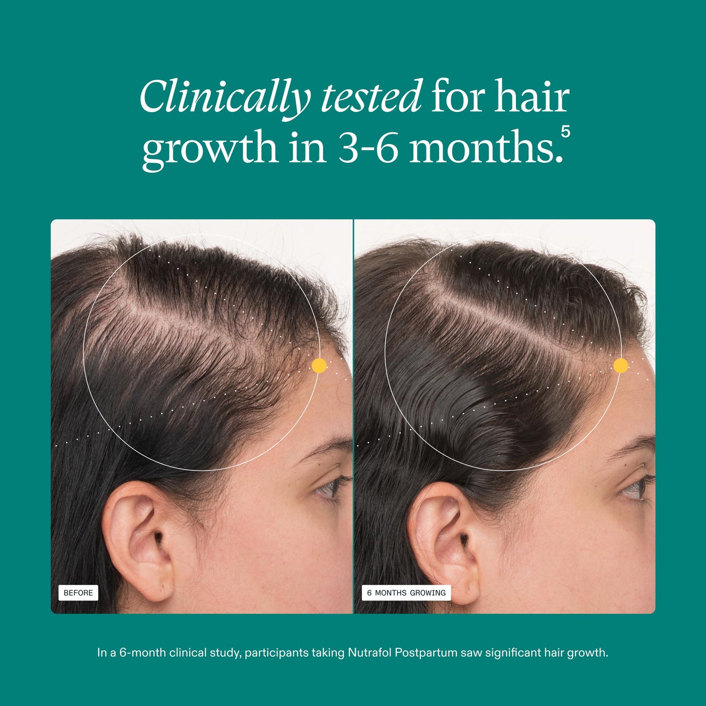 Nutrafol Postpartum Hair Growth Supplements, Clinically Tested for Visibly Thicker Hair and Less Shedding, Breastfeeding-friendly - 2 Month Supply, Pack of 2