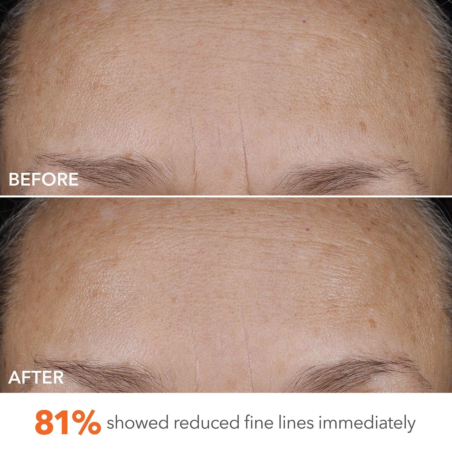 Dr Dennis Gross DermInfusions Blur + Repair Cream, Instantly Blurs Fine Lines, Smooths Skin with Satin-Matte Finish, Visibly Plumps & Firms, Reduces Redness, and Improves Skin Elasticity, 1.7 Fl Oz