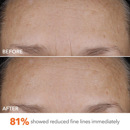 Dr Dennis Gross DermInfusions Blur + Repair Cream, Instantly Blurs Fine Lines, Smooths Skin with Satin-Matte Finish, Visibly Plumps & Firms, Reduces Redness, and Improves Skin Elasticity, 1.7 Fl Oz